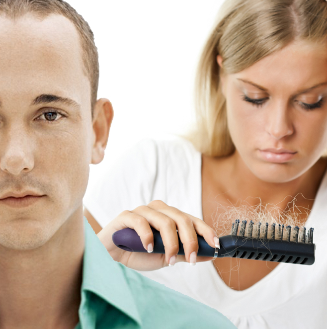 PRP Hair Restoration